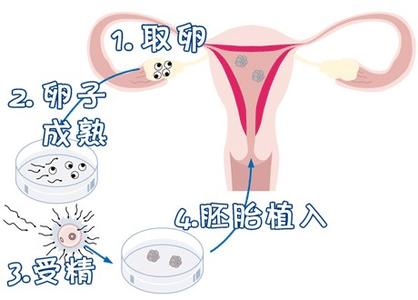 包生男孩公司